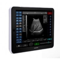 nuevo escáner de ultrasonido