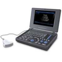 loptop sistema de diagnóstico por ultrasonidos