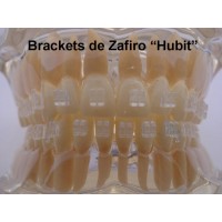 Brackets de Zafiro