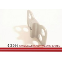 CDH Opening Wedge Osteotomy (Tcnica PUDDU)
